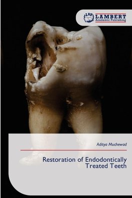 Restoration of Endodontically Treated Teeth