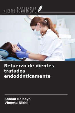 Refuerzo de dientes tratados endodónticamente