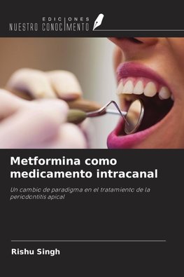 Metformina como medicamento intracanal
