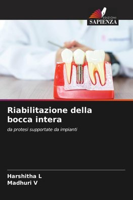 Riabilitazione della bocca intera
