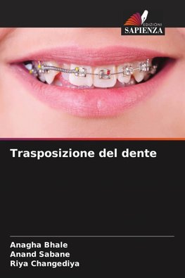 Trasposizione del dente