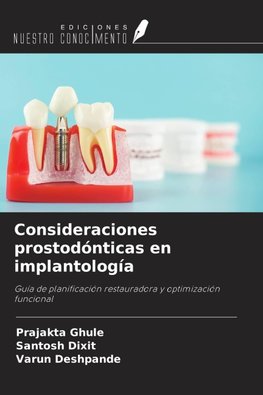 Consideraciones prostodónticas en implantología