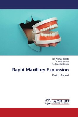 Rapid Maxillary Expansion