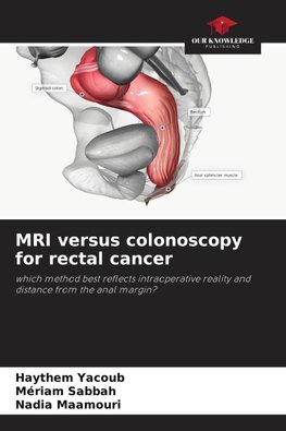 MRI versus colonoscopy for rectal cancer