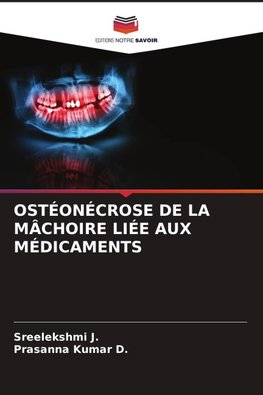OSTÉONÉCROSE DE LA MÂCHOIRE LIÉE AUX MÉDICAMENTS