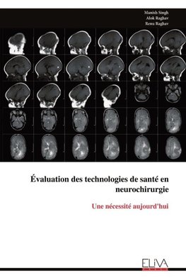 Évaluation des technologies de santé en neurochirurgie