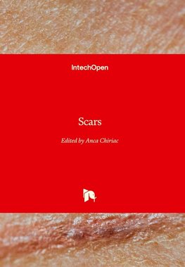 Scars