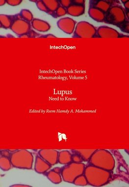 Lupus