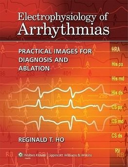 Ho, R: Electrophysiology of Arrhythmias