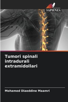 Tumori spinali intradurali extramidollari