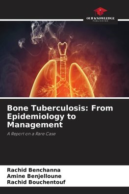 Bone Tuberculosis: From Epidemiology to Management