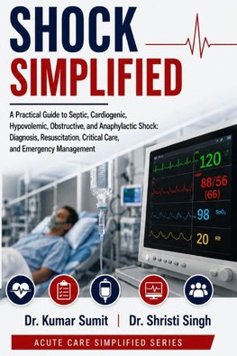 Shock Simplified