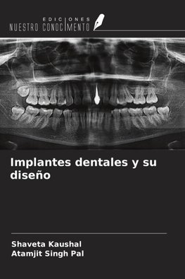 Implantes dentales y su diseño