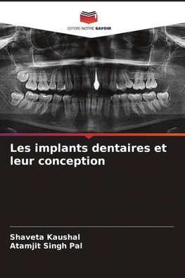 Les implants dentaires et leur conception