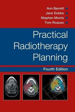 Practical Radiotherapy Planning