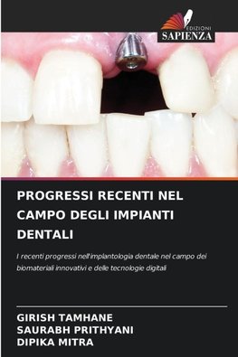 PROGRESSI RECENTI NEL CAMPO DEGLI IMPIANTI DENTALI