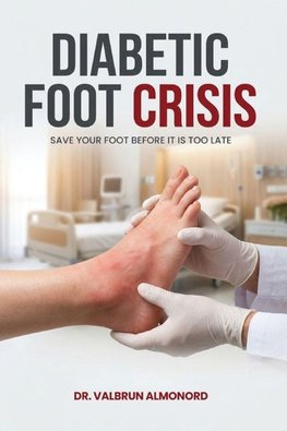 The Diabetic Foot Crisis Save Your Foot