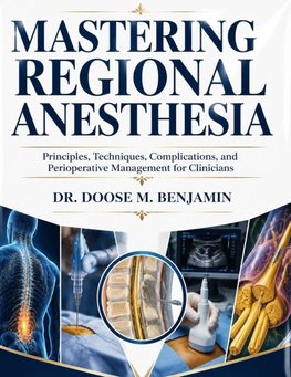 MASTERING Regional anesthesia