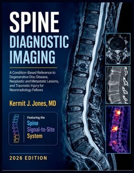 Spine Diagnostic Imaging 2026