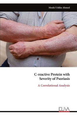 C-reactive Protein with  Severity of Psoriasis