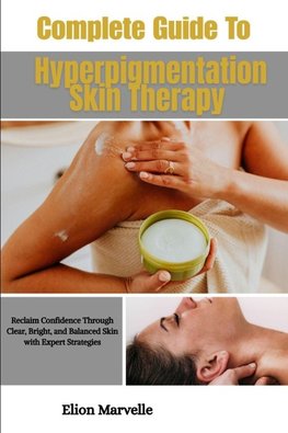 Complete Guide To Hyperpigmentation Skin Therapy