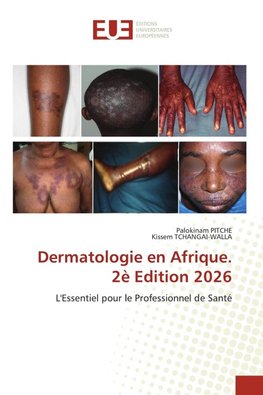 Dermatologie en Afrique. 2è Edition 2026