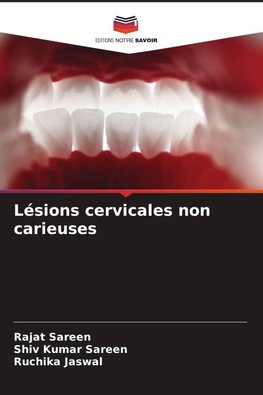 Lésions cervicales non carieuses