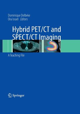 Hybrid PET/CT and SPECT/CT Imaging