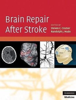 Brain Repair After Stroke