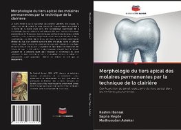 Morphologie du tiers apical des molaires permanentes par la technique de la clairière