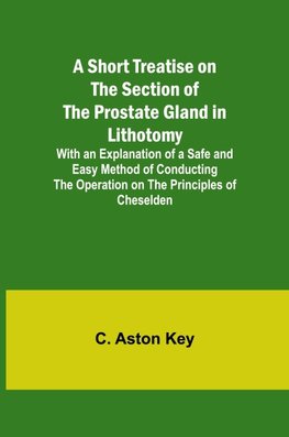 A Short Treatise on the Section of the Prostate Gland in Lithotomy;With an Explanation of a Safe and Easy Method of Conducting the Operation on the Principles of Cheselden