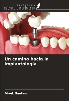 Un camino hacia la implantología